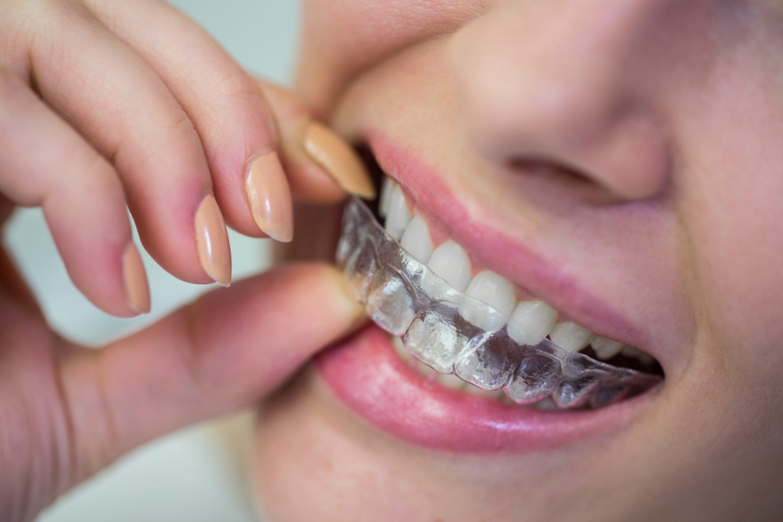 ataches dientes