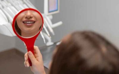 Blanqueamiento dental en casa con ferulas