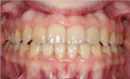 Captura de pantalla 2026-07-28 150531 blanqueamiento dental en Málaga